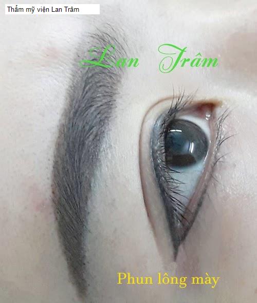 Thẩm mỹ viện Lan Trâm